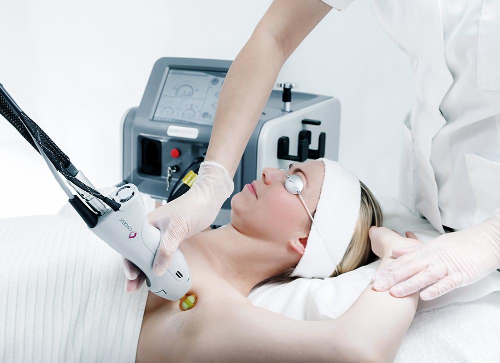 laser hair removal